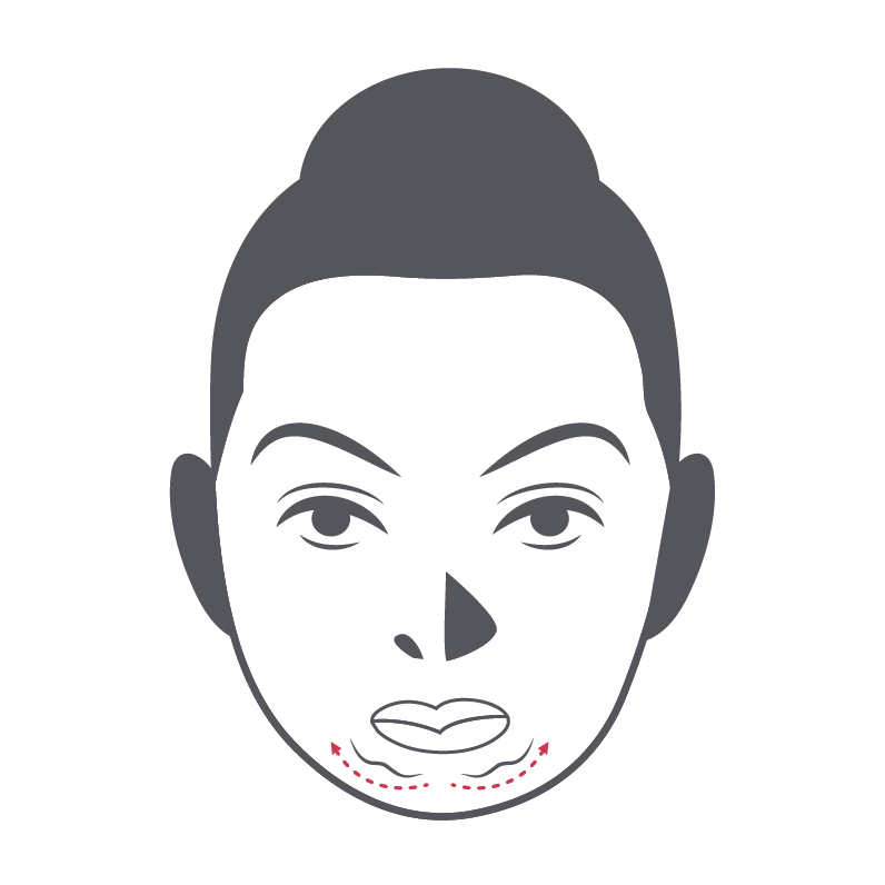 Chin Lines