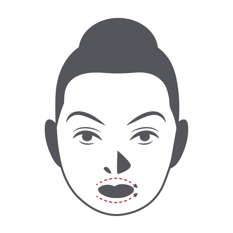 Lip Augmentation
