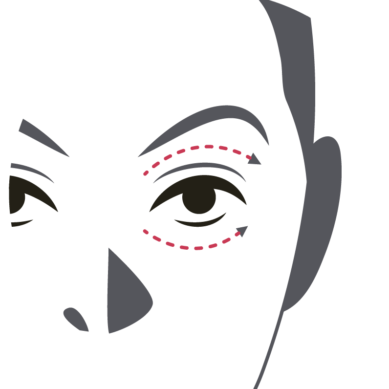 Under-Eye Hollows