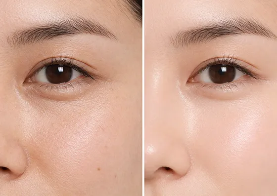 Skin Journey