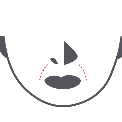 Nasolabial Folds